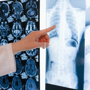 radiografia ossa